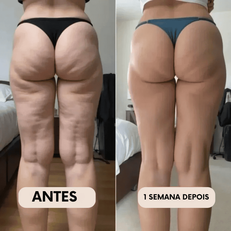 Legging Modeladora Anti-Celulite BelleFit™ 3D – Efeito Levanta Bumbum e Barriga Chapada