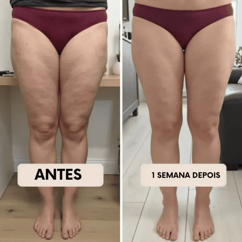 Legging Modeladora Anti-Celulite BelleFit™ 3D – Efeito Levanta Bumbum e Barriga Chapada