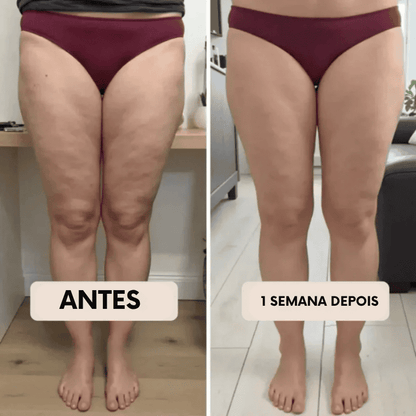 Legging Modeladora Anti-Celulite BelleFit™ 3D – Efeito Levanta Bumbum e Barriga Chapada