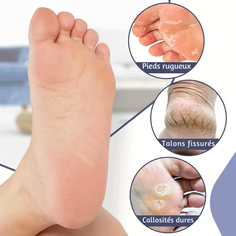 LureCare – Chaussettes hydratantes anti-fissures pour les pieds