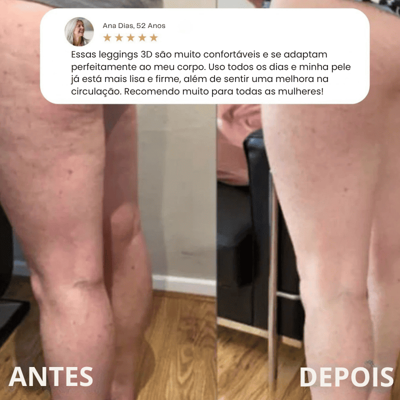 Legging Modeladora Anti-Celulite BelleFit™ 3D – Efeito Levanta Bumbum e Barriga Chapada